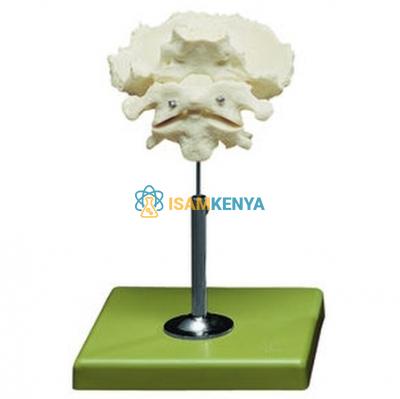 Atlas Axis and Occipital Bone Model