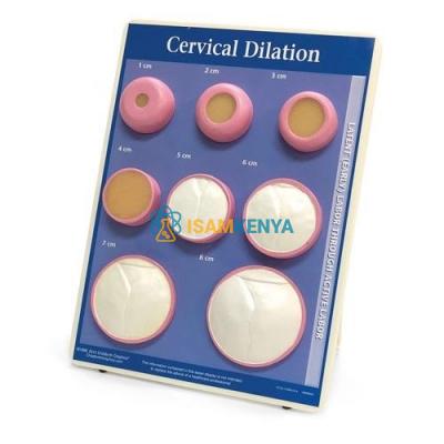 Cervical Dilatation Model