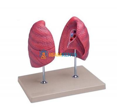 Human Lung Model