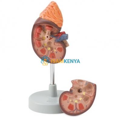 Kidney with Adrenal Gland Model, 1.5 Times Enlarged